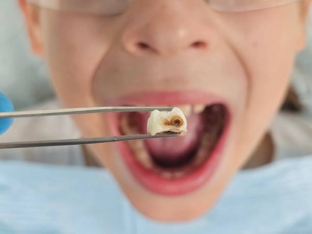 Best Emergency Gum Treatment in Glenwood, AR